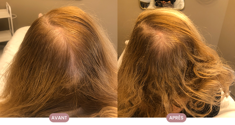 Transformation réelle d'une cliente Crüe avec des cheveux brillants et nourris