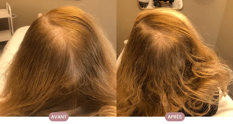 Transformation réelle d'une cliente Crüe avec des cheveux brillants et nourris