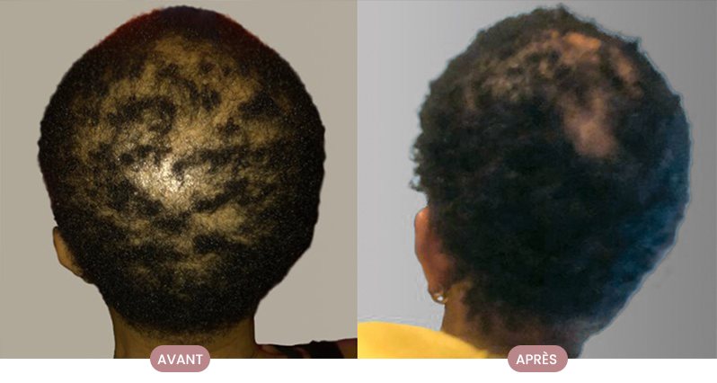 Cheveux lisses et soyeux après la routine personnalisée Crüe