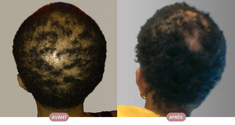 Cheveux lisses et soyeux après la routine personnalisée Crüe