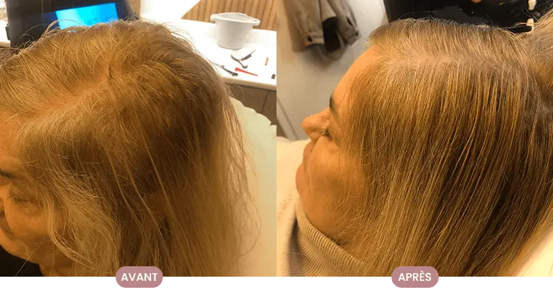 Avant-après d'une cliente Crüe montrant des cheveux plus longs et sains