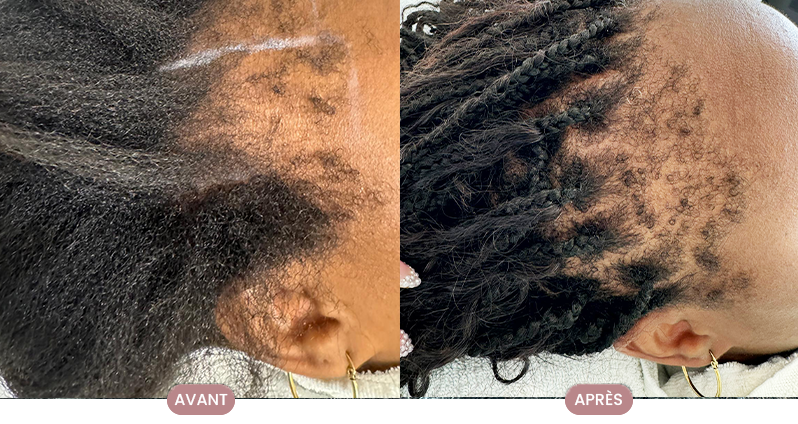Avant et après la transformation capillaire d'une cliente Crüe, montrant des cheveux revitalisés et nourris