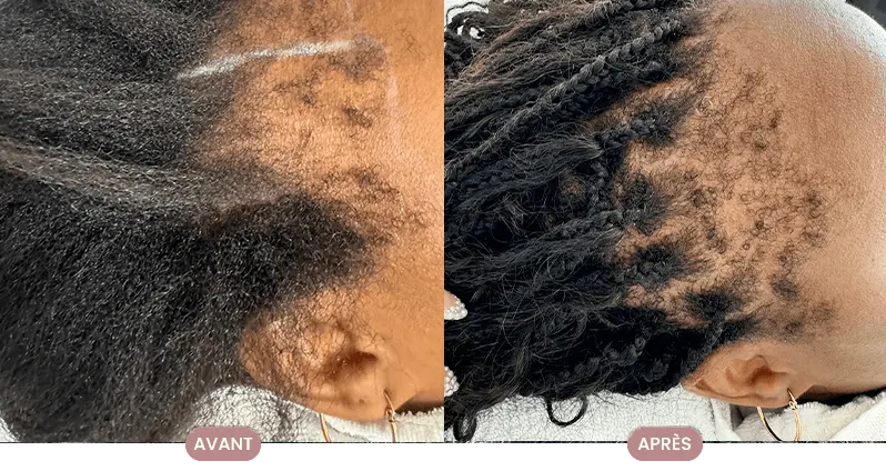 Avant et après la transformation capillaire d'une cliente Crüe, montrant des cheveux revitalisés et nourris